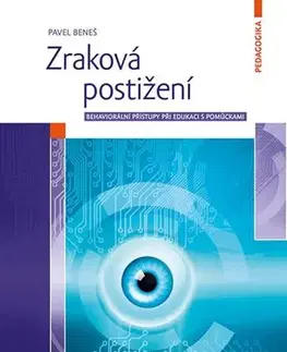 Medicína - ostatné Zraková postižení - Pavel Beneš