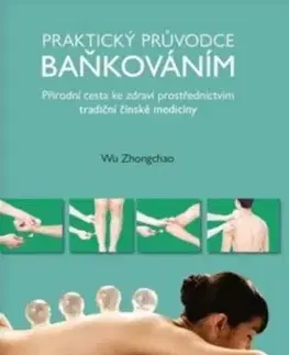 Masáže, wellnes, relaxácia Praktický průvodce baňkováním - Wu Zhongchao