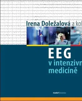 Medicína - ostatné EEG v intenzivní medicíně - Irena Doležalová