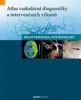 Medicína - ostatné Atlas vaskulární diagnostiky a intervenčních výkonů - Petr Novobilský,Václav Procházka