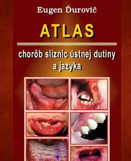 Medicína - ostatné Atlas chorôb slizníc ústnej dutiny a jazyka - Eugen Ďurovič