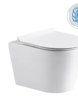 Záchody CERANO - Kompletný WC set Basic/Carlito - biela lesklá - WC tlačidlo Dualo/Biela - voľne stojaca - predstenová inštalácia - 48,5x36,5 CER-8050BD86017