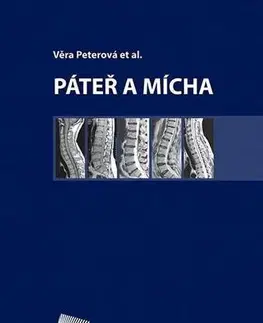 Medicína - ostatné Páteř a mícha - Věra Peterová