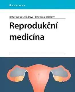 Medicína - ostatné Reprodukční medicína - Kateřina Veselá,Kolektív autorov