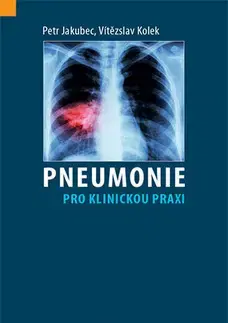 Medicína - ostatné Pneumonie pro klinickou praxi - Petr Jakubec,Vítězslav Kolek
