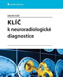 Medicína - ostatné Klíč k neuroradiologické diagnostice - Zdeněk Seidl