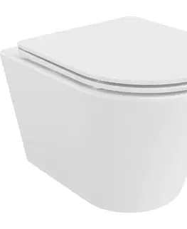 Záchody MEXEN/S - Rico Závesná WC misa Rimless Tornado vrátane sedátka s slow slim, duroplast, biela lesk 30720300T