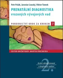 Medicína - ostatné Prenatální diagnostika vrozených vývojových vad, 2. vydání - Jaroslav Loucký,Petr Polák,Viktor Tomek