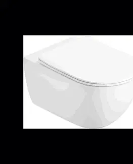 Záchody MEXEN - Carmen Závesná WC misa Rimless Tornado vrátane sedátka s slow slim, duroplast, biela lesk 3088L4000T