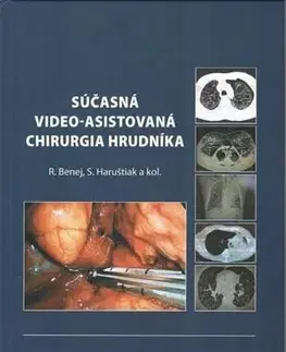 Chirurgia, ortopédia, traumatológia Súčasná video-asistovaná chirurgia hr... - Roman Benej,Svetozár Haruštiak
