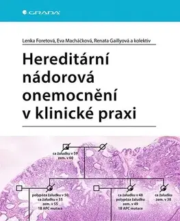 Medicína - ostatné Hereditární nádorová onemocnění v klinické praxi - Lenka Foretová,Renata Gaillyová,Kolektív autorov,Eva Macháčková