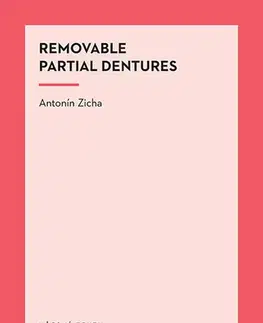 Stomatológia Removable Partial Dentures - Antonín Zicha