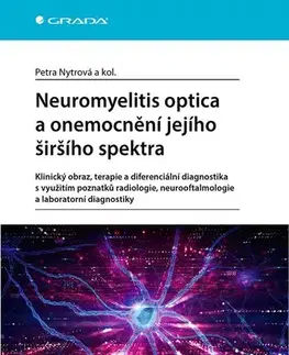 Medicína - ostatné Neuromyelitis optica a poruchy jejího širšího spektra - Petra Nytrová,Kolektív autorov