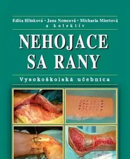 Medicína - ostatné Nehojace sa rany - Edita Hlinková,Jana Nemcová,Michaela Miertová