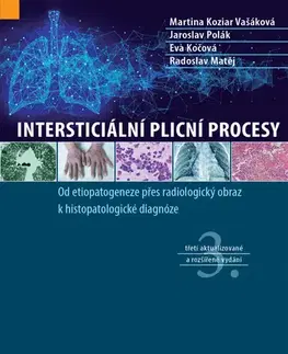 Medicína - ostatné Intersticiální plicní procesy, 3. vydání - Martina Vašáková,Jaroslav Polák,Matěj Radoslav