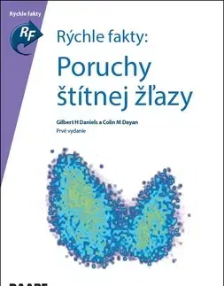 Medicína - ostatné Rýchle fakty : Poruchy štítnej žľazy - Kolektív autorov