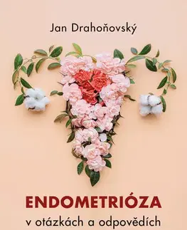 Medicína - ostatné Endometrióza v otázkách a odpovědích - Jan Drahoňovský