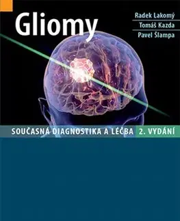Medicína - ostatné Gliomy (2. vydání) - Radek Lakomý,Tomáš Kazda,Pavel Šlampa