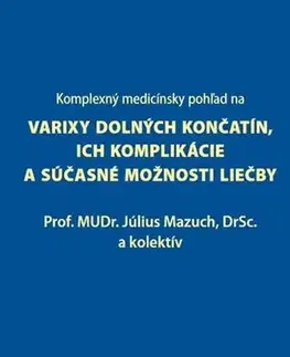 Medicína - ostatné Komplexný medicínsky pohľad na varixy dolných končatín, ich komplikácie a súčasné možnosti liečby - Július Mazúch