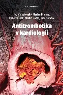 Medicína - ostatné Antitrombotika v kardiologii - Kolektív autorov