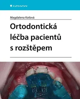 Medicína - ostatné Ortodontická léčba pacientů s rozštěpem - Magdalena Koťová