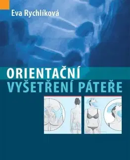 Medicína - ostatné Orientační vyšetření páteře - Eva Rychlíková