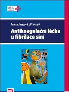 Medicína - ostatné Antikoagulační léčba u fibrilace síní - Jiří Veselý,Tereza Švarcová