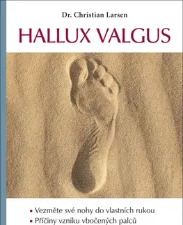 Zdravoveda, ochorenia, choroby Hallux valgus - Christian Larsen