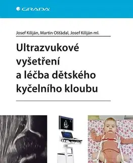 Medicína - ostatné Ultrazvukové vyšetření a léčba dětského kyčelního kloubu - Josef Kiliján,Martin Ošťádal,Josef Kiliján ml.,Kolektív autorov