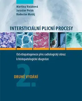Medicína - ostatné Intersticiální plicní procesy - Kolektív autorov