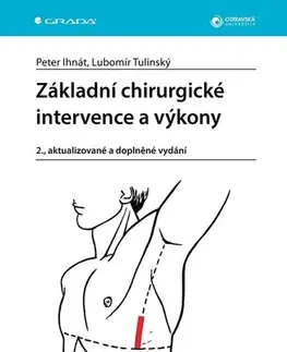 Chirurgia, ortopédia, traumatológia Základní chirurgické intervence a výkony, 2., aktualizované a doplněné vydání - Lubomír Tulinský,Peter Ihnát