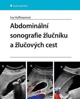 Medicína - ostatné Abdominální sonografie žlučníku a žlučových cest - Iva Hoffmanová