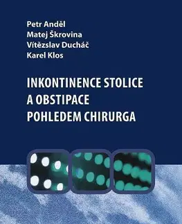 Medicína - ostatné Inkontinence stolice a obstipace pohledem chirurga - Anděl Petr,Vítězslav Ducháč,Karel Klos,Matej Škrovina