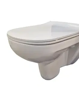 Závesné wc sety PRIM predstenový inštalačný systém bez tlačidla + WC bez oplachového kruhu Edge + SEDADLO PRIM_20/0026 X EG1