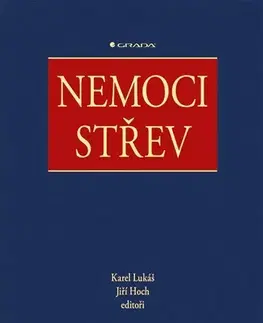 Medicína - ostatné Nemoci střev - Lukáš Karel,Jiří Hoch
