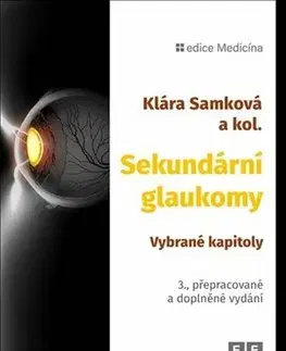 Medicína - ostatné Sekundární glaukomy. Vybrané kapitoly, 3. vydání - Kolektív autorov