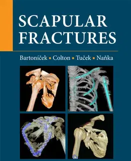 Chirurgia, ortopédia, traumatológia Scapular fractures - Kolektív autorov