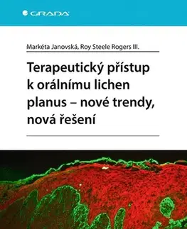 Medicína - ostatné Terapeutický přístup k orálnímu lichen planus - nové trendy, nová řešení - Markéta Janovská,Roy Steele Rogers III.