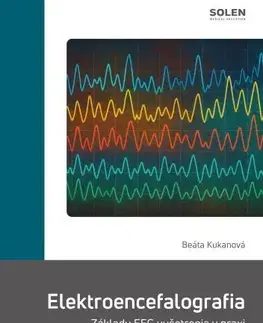 Medicína - ostatné Elektroencefalografia - Beáta Kukanová
