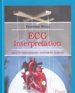 Pre vysoké školy ECG - Interpretation - František Nehaj