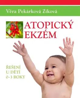 Medicína - ostatné Atopický ekzém - Věra Pekárková Zíková