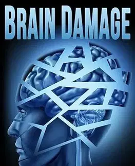 Detektívky, trilery, horory Brain Damage - Freida McFadden