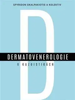 Medicína - ostatné Dermatovenerologie v kasuistikách - Spyridon Gkalpakiotis