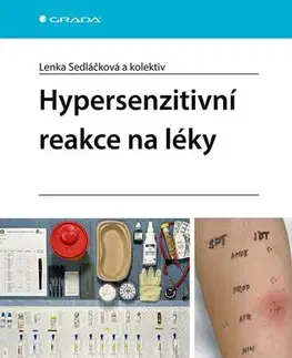 Medicína - ostatné Hypersenzitivní reakce na léky - Lenka Sedláčková,Kolektív autorov