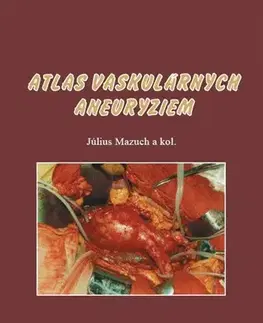 Medicína - ostatné Atlas vaskulárnych aneuryziem - Július Mazúch