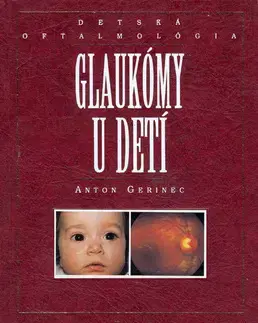 Medicína - ostatné Glaukómy u detí - Anton Gerinec