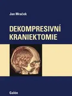 Medicína - ostatné Dekompresivní kraniektomie - Jan Mraček
