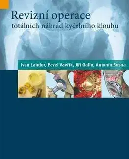 Medicína - ostatné Revizní operace totálních náhrad kyčelního kloubu - Jiří Gallo,Ivan Landor,Pavel Vavřík