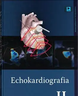 Medicína - ostatné Echokardiografia II. - Ingrid Schusterová,Daniela Ondušová