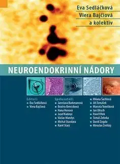 Medicína - ostatné Neuroendokrinní nádory - Eva Sedláčková